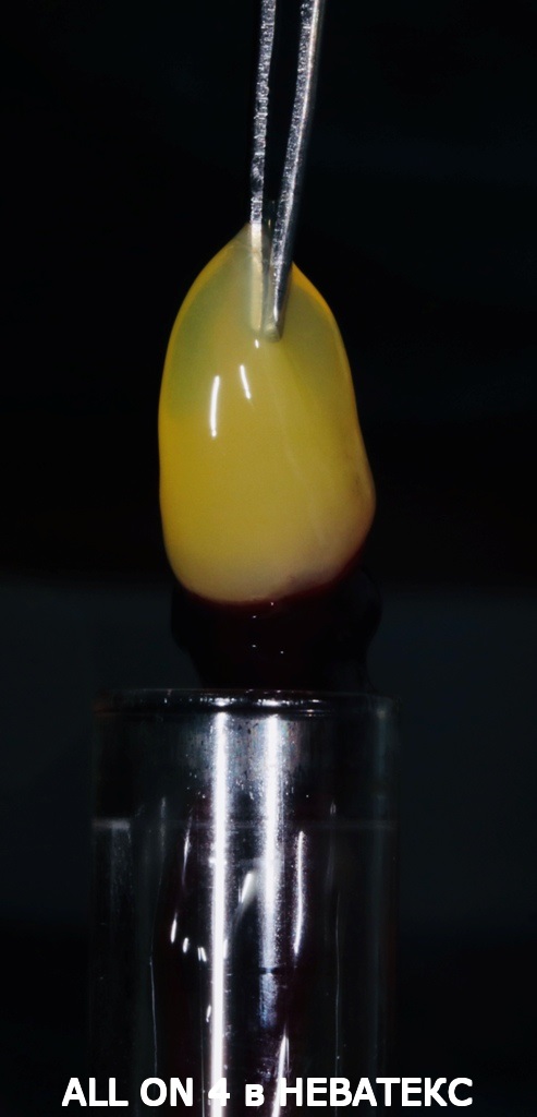 факторы роста all on 4 имплантация